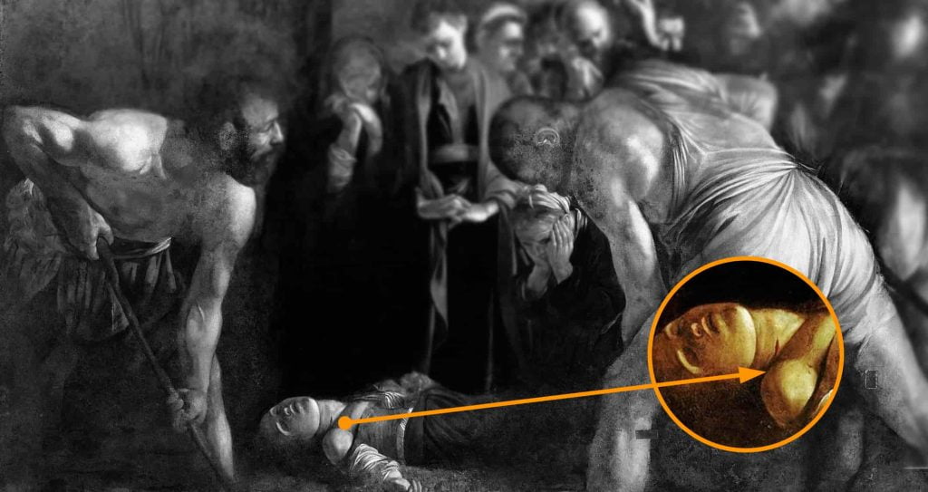 Detail showing Lucia’s throat wound and the disengaged expressions of two men in Caravaggio’s painting.