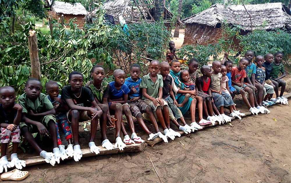 The Fight to Eliminate Jiggers Disease - In Pictures